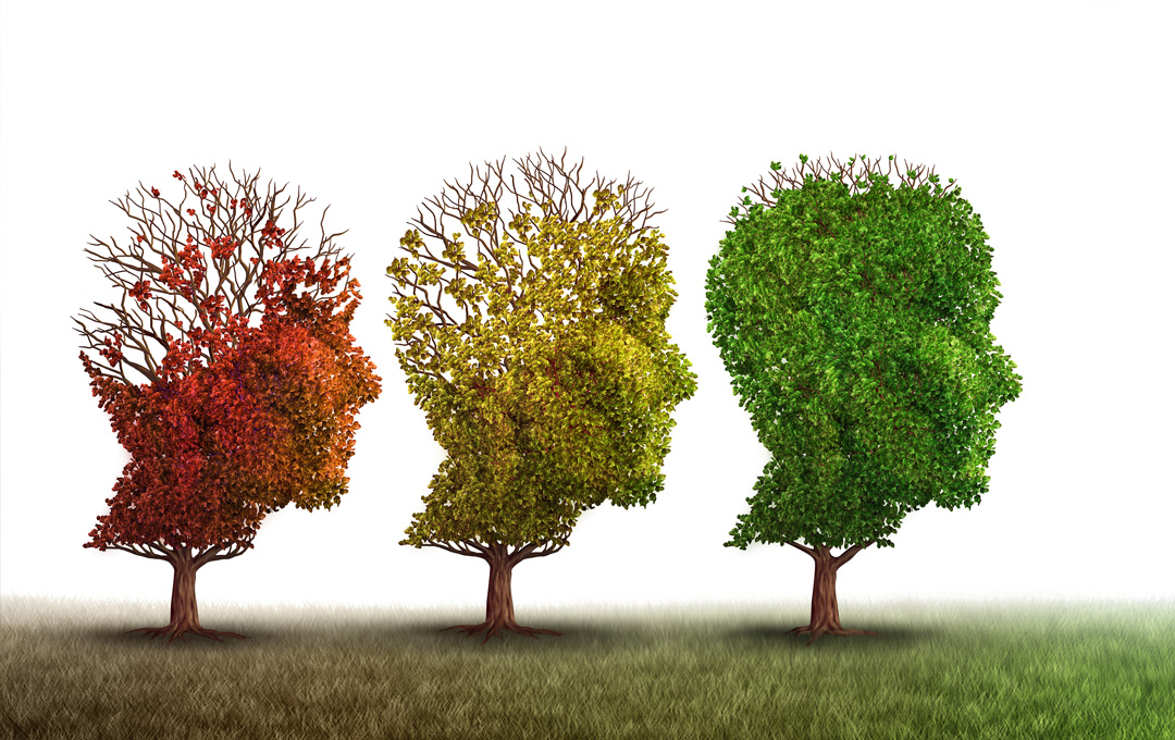 Alzheimer’s Disease
